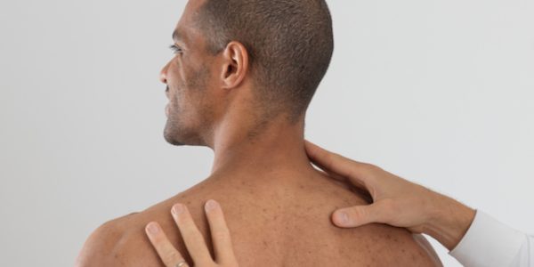 nekpijn manueel therapeut nekpijn manueel therapeut